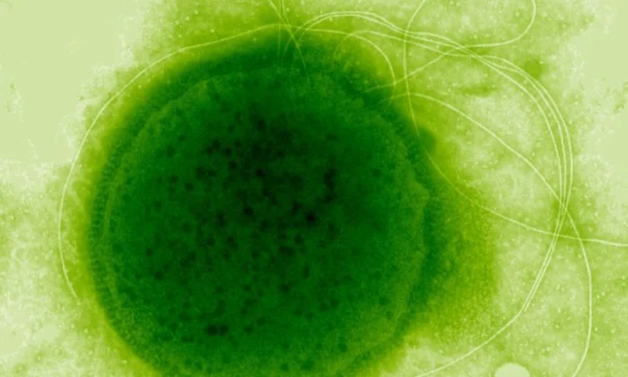 Ученые раскрыли секрет невероятной радиационной устойчивости микроба из гидротермальных источников